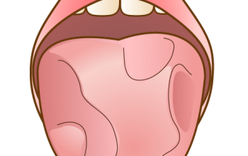 舌がんについて