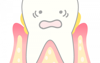 歯周病の検査のお話